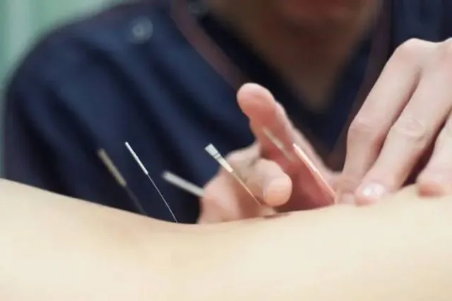 Western medical acupuncture on a muscle